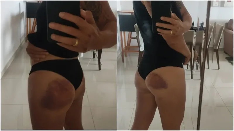 Policiais femininas sofreram spray de pimenta nos olhos durante curso no Ceará, relata participante