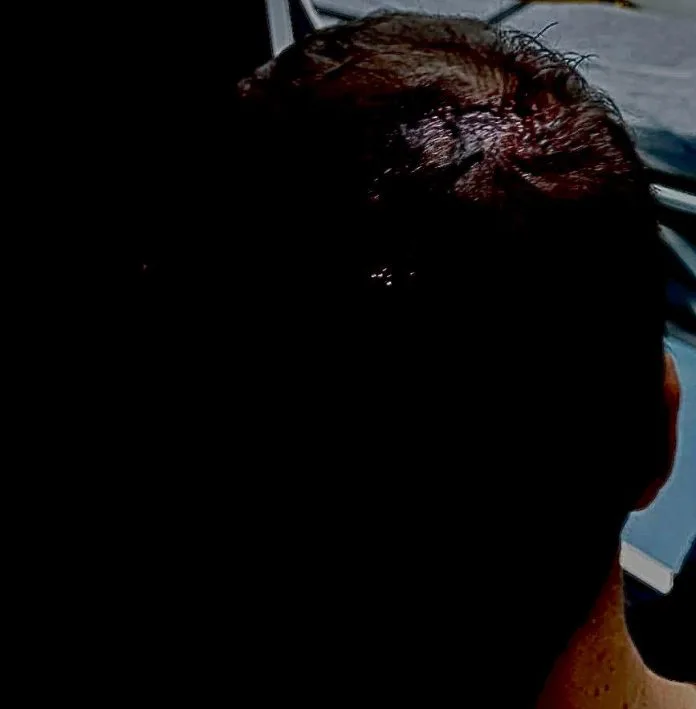 Briga em festa termina com homem ferido em Criciúma