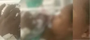 Criança recém-nascida tem cabeça cortada durante parto em Joinville