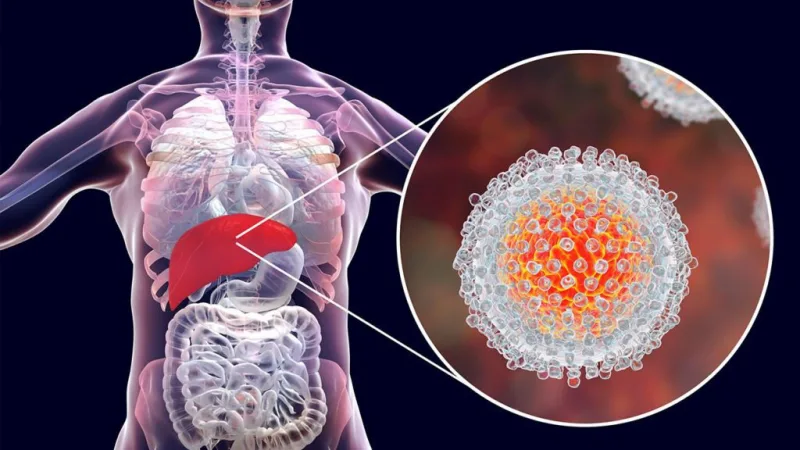 Julho Amarelo alerta para prevenção e tratamento de hepatites virais