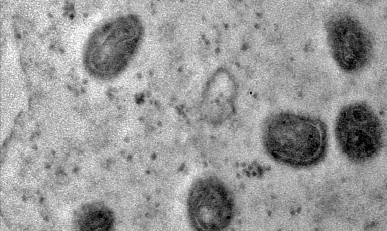 Sem casos de Mpox desde maio, Secretaria de Saúde de SC segue em alerta