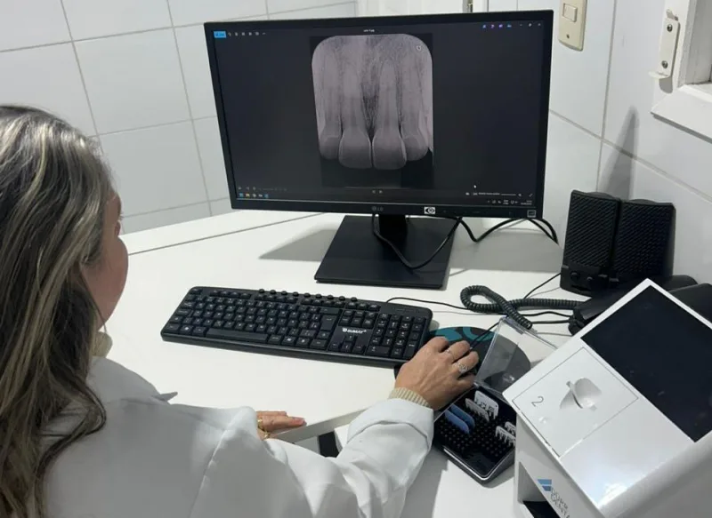 Cocal do Sul moderniza radiologia odontológica e reduz tempo de espera dos pacientes em até uma semana