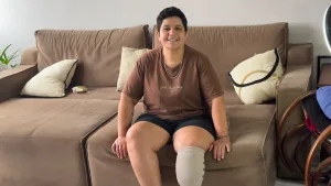 Moradora de Criciúma faz campanha solidária para custear prótese após amputação